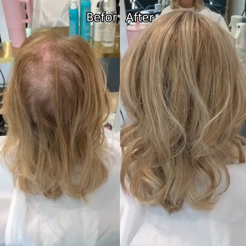 ⚡ Final Hours –⚡2026 New Lightweight & Breathable Wavy Hair Topper